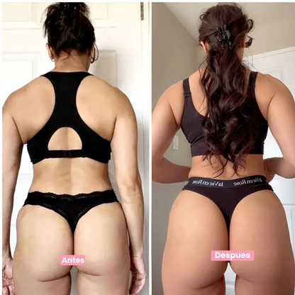 Gluteos Perfectos Antes Del 2027®